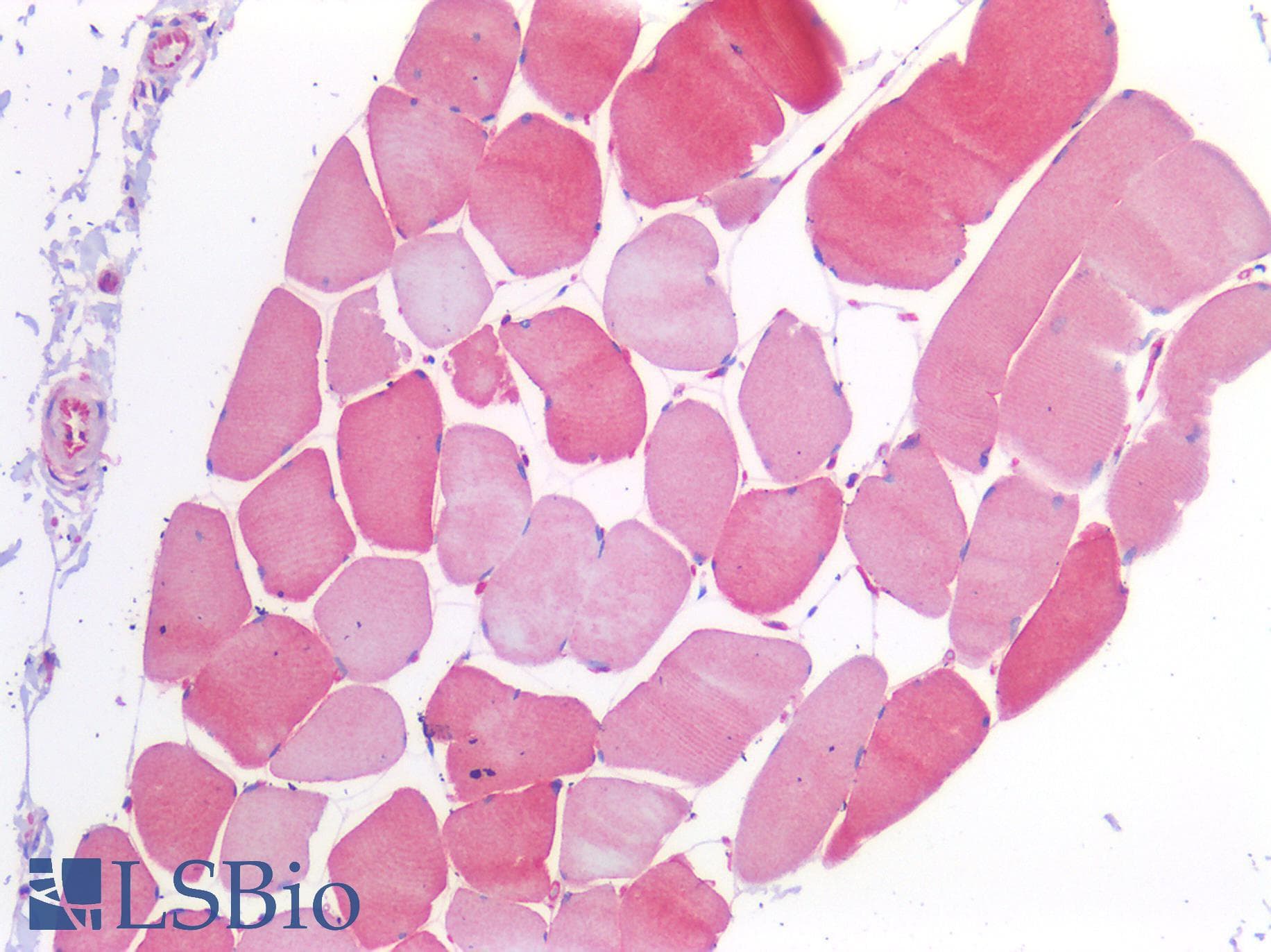 PathPlus™ NOS2 / iNOS Antibody