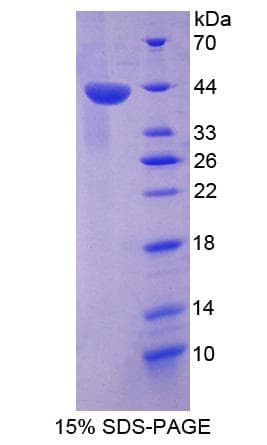 Human TP53TG5 Protein (Recombinant His-GST)