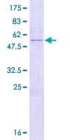 Human SETBP1 / SEB Protein (Recombinant GST)