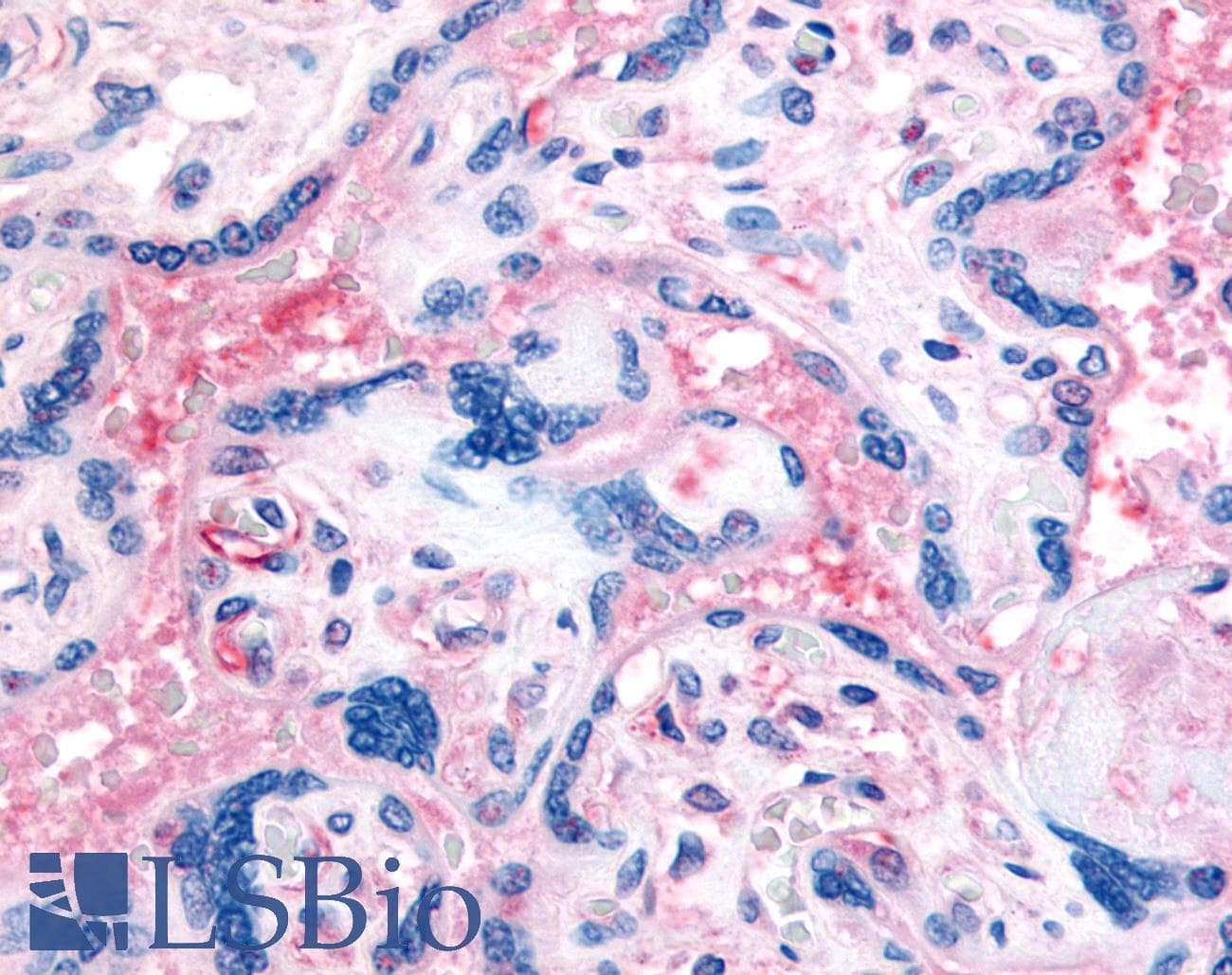 IHC-plus™ Polyclonal Rabbit anti-Human ITGB3 / Integrin Beta 3 / CD61 Antibody (Internal, IHC)
