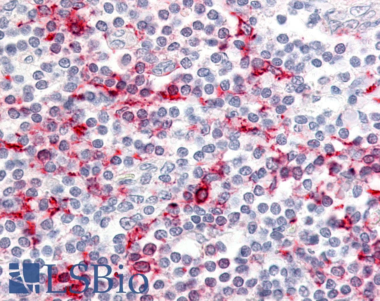 IHC-plus™ Polyclonal Rabbit anti-Human CCR6 Antibody (C-Terminus, IHC)