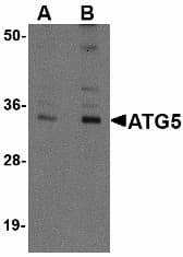 APG5 / ATG5 Antibody