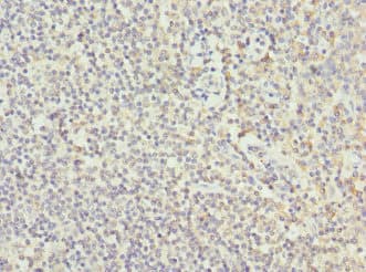 Polyclonal Rabbit anti-Human COL9A3 / Collagen IX Antibody (IHC, WB)