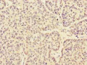 ARHGEF3 / XPLN Antibody
