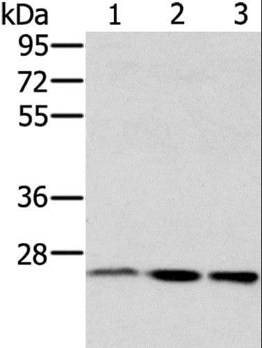 Polyclonal Rabbit anti-Human RAB8A / RAB8 Antibody (IHC, WB)