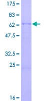 Human DFFB Protein (Recombinant GST)