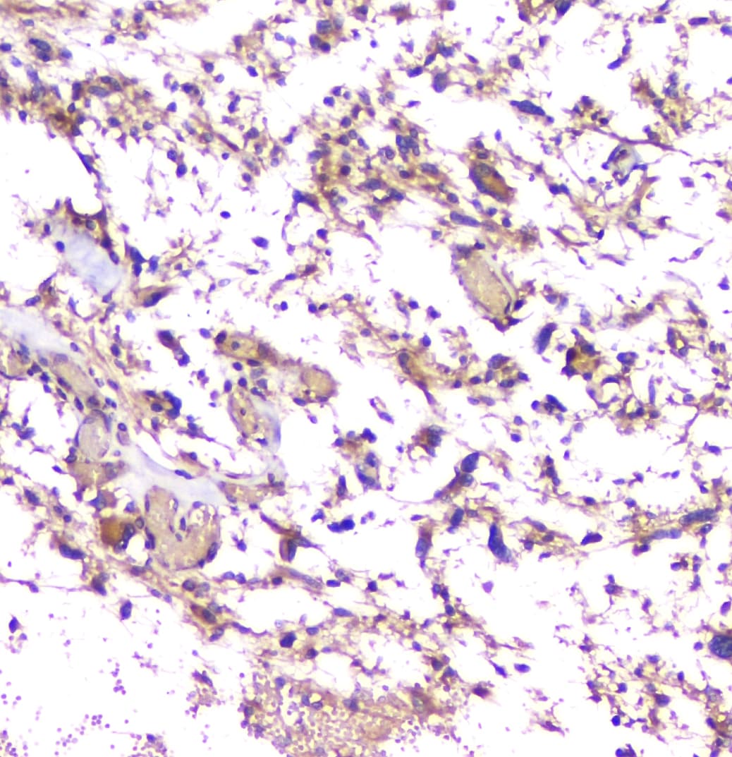 APP / Beta Amyloid Precursor Antibody (aa672-713)