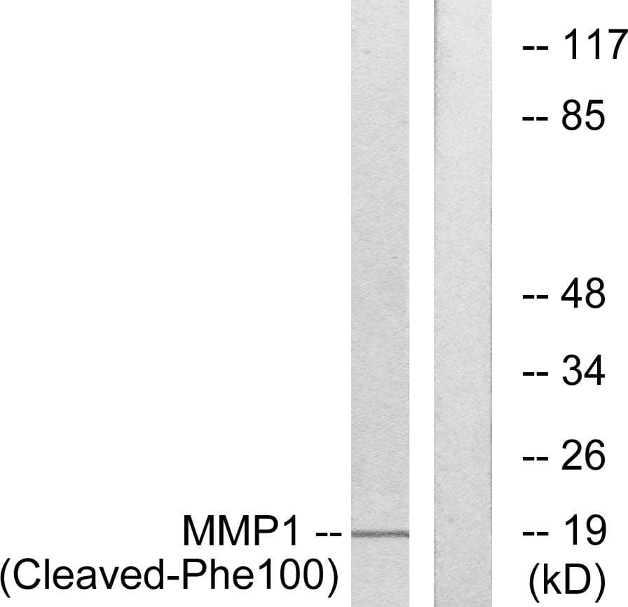 MMP1 Antibody (Cleaved-Phe100)