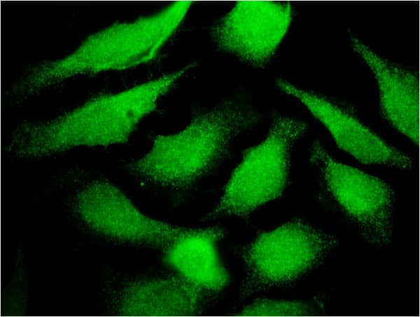 Monoclonal Mouse anti-Human TF / Transferrin Antibody (clone 1C2, IF, WB)