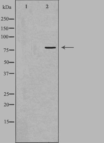 ADRBK2 / GRK3 Antibody