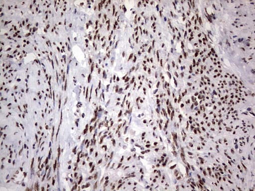 C14orf166 Antibody (clone OTI1E5)
