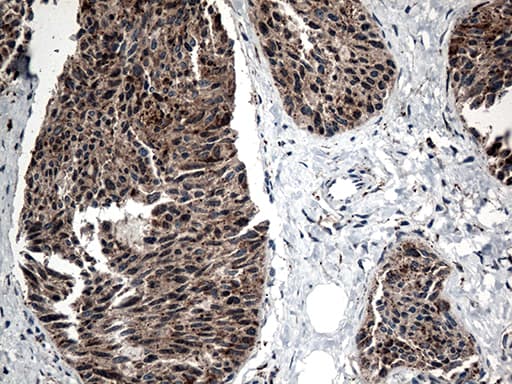 Monoclonal Mouse anti-Human CTSL / Cathepsin L Antibody (clone OTI6D5, aa114-333, IHC, WB)