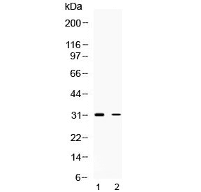 TNFAIP6 / TSG-6 Antibody