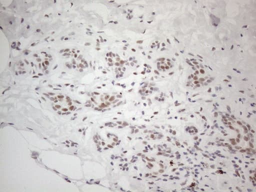 TP53BP1 / 53BP1 Antibody (aa1-300, clone OTI5E1)