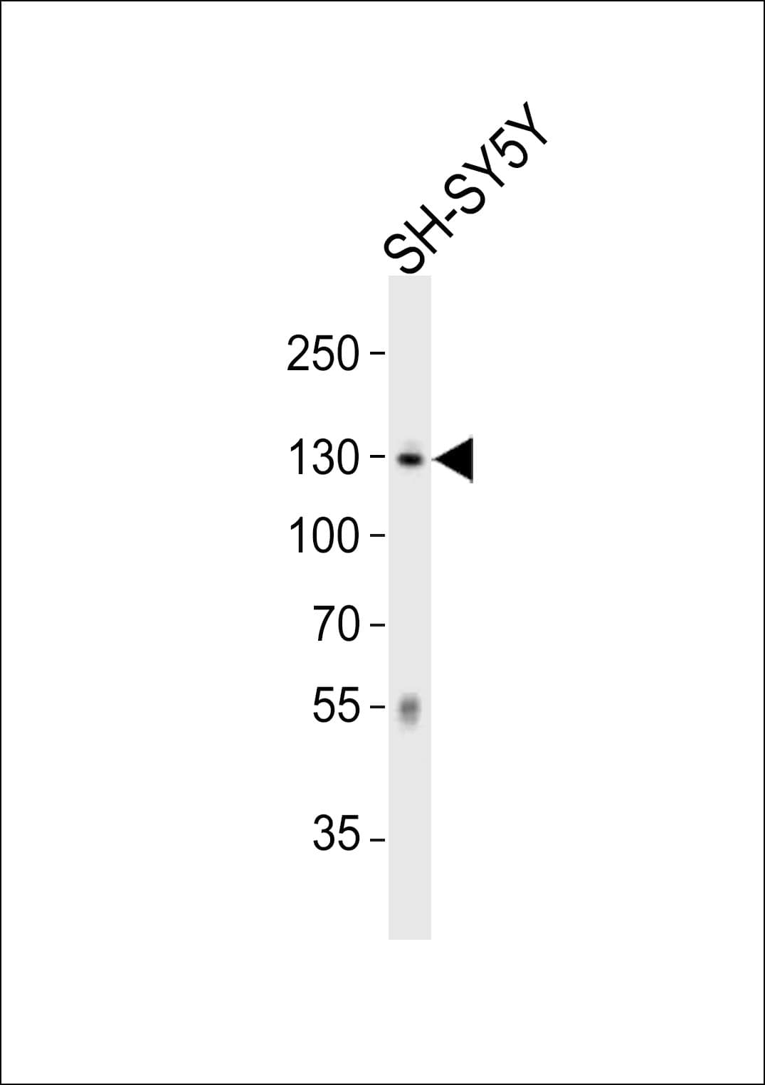 Polyclonal Rabbit anti-Human MAPT / Tau Antibody (aa694-728, WB)