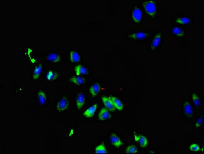 Polyclonal Rabbit anti-Human SMO / Smoothened Antibody (IHC, IF, WB)