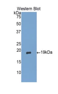 GKN1 / Gastrokine 1 Antibody (aa40-190)