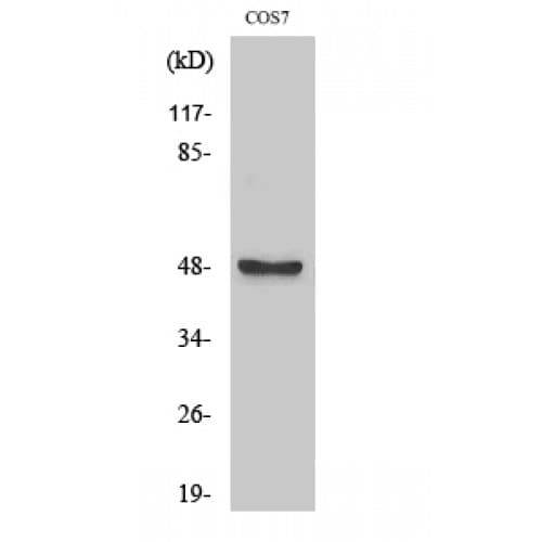 AURKA / Aurora-A Antibody (280-360 aa)