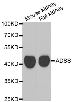 GATM / AGAT Antibody