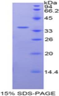 Bovine TF / Transferrin Protein (Recombinant His, N-Terminal)