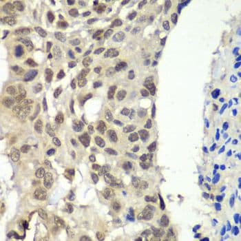 FACT / SSRP1 Antibody