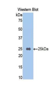 CPB2 / TAFI Antibody (aa187-327)