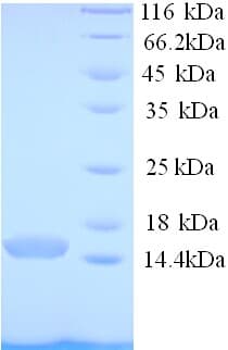 Human PCBD1 / PHS Protein (Recombinant His)