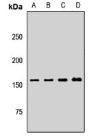 CENTD2 / ARAP1 Antibody