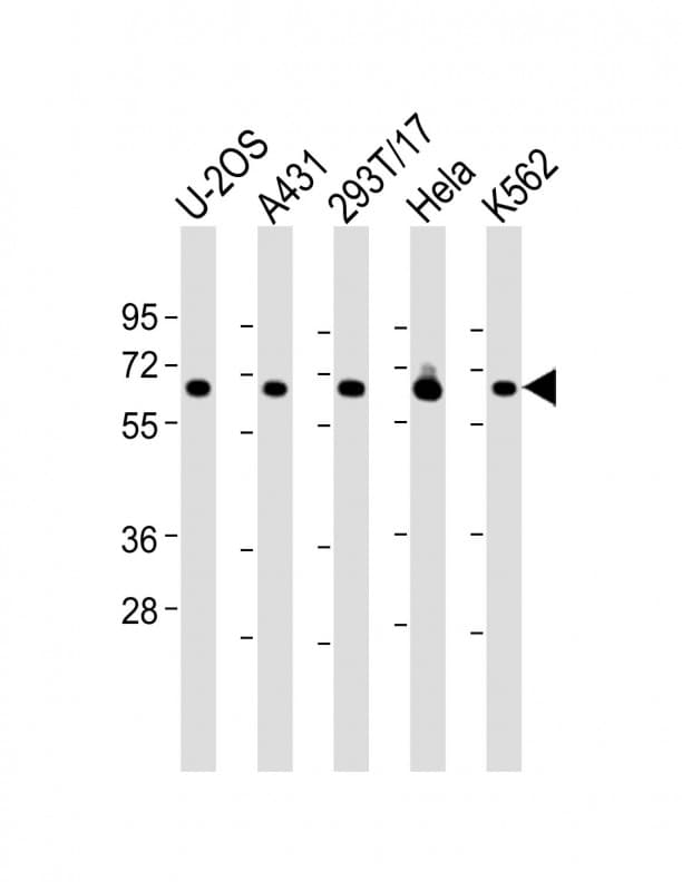 Polyclonal Rabbit anti-Human RSL1D1 Antibody (C-Terminus, WB)