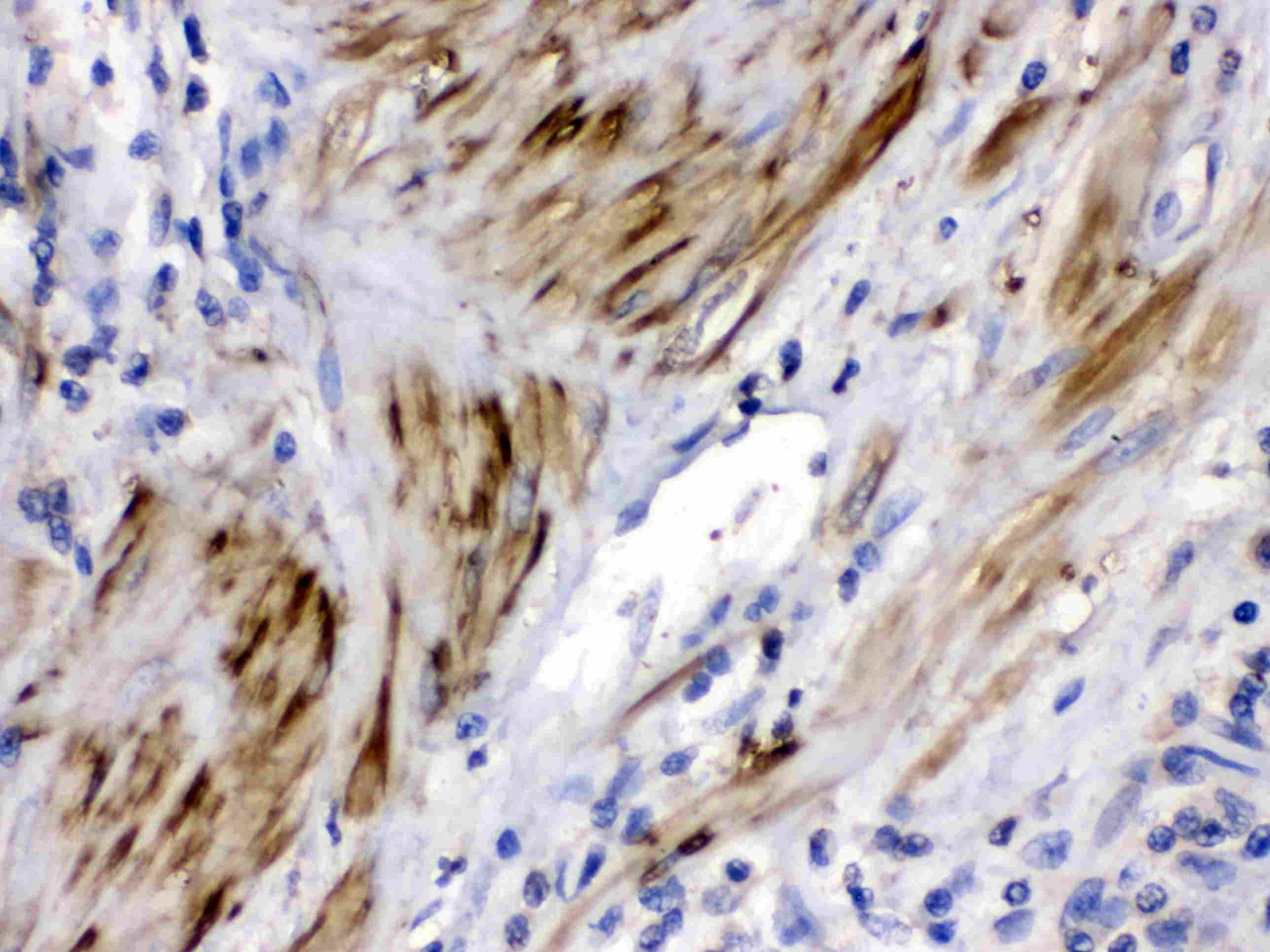 Polyclonal Rabbit anti-Human CFL2 / Cofilin 2 Antibody (IHC, WB)