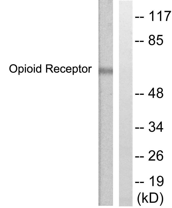 CCR5 Antibody (aa303-352)