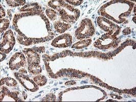 RPN1 / Ribophorin I Antibody (clone OTI6A9)