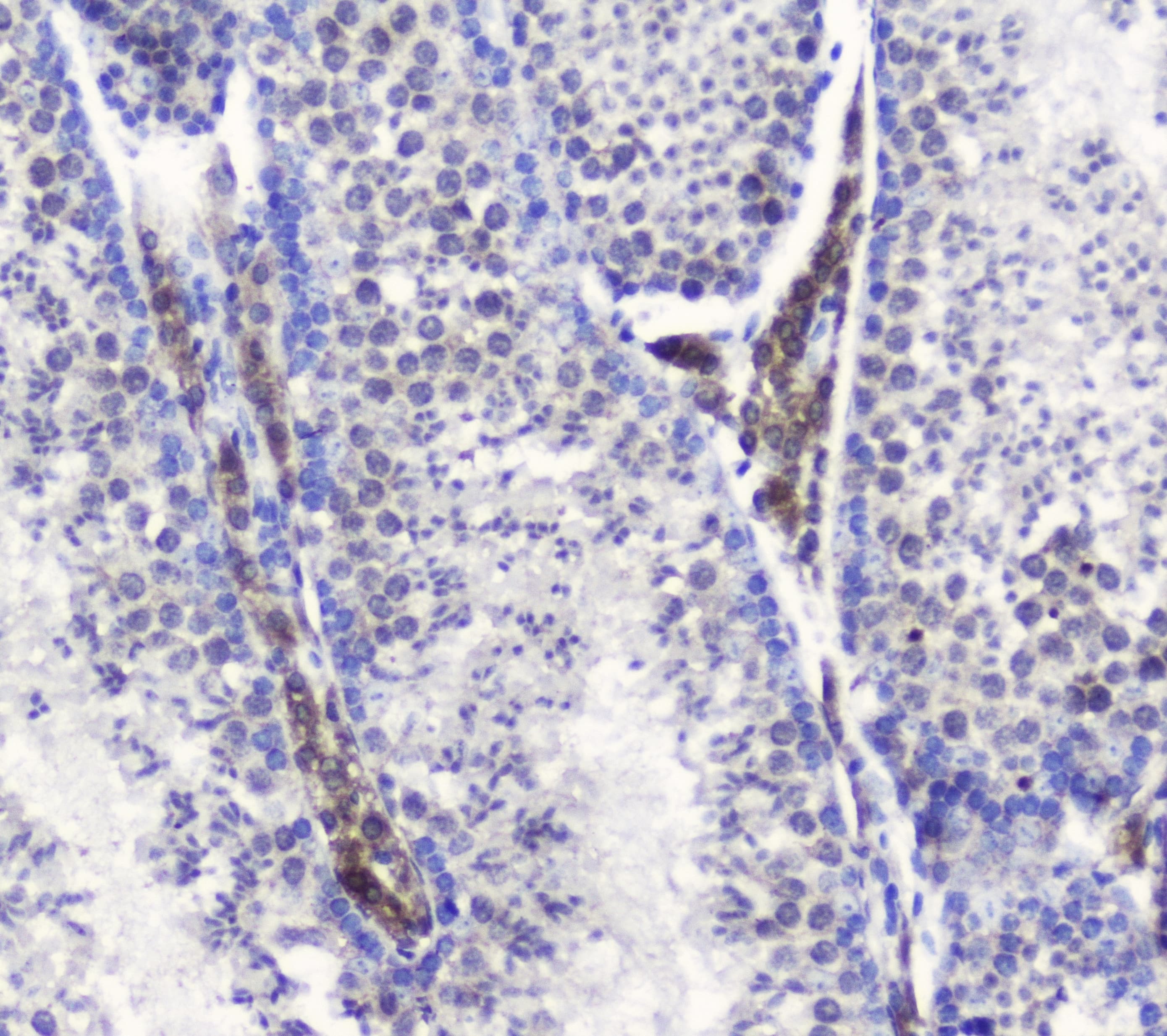 Polyclonal Rabbit anti-Human SMC6 Antibody (WB)