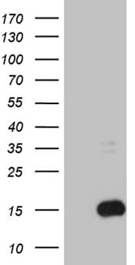 S100B / S100 Beta Antibody (clone OTI3G6, Carrier-free)