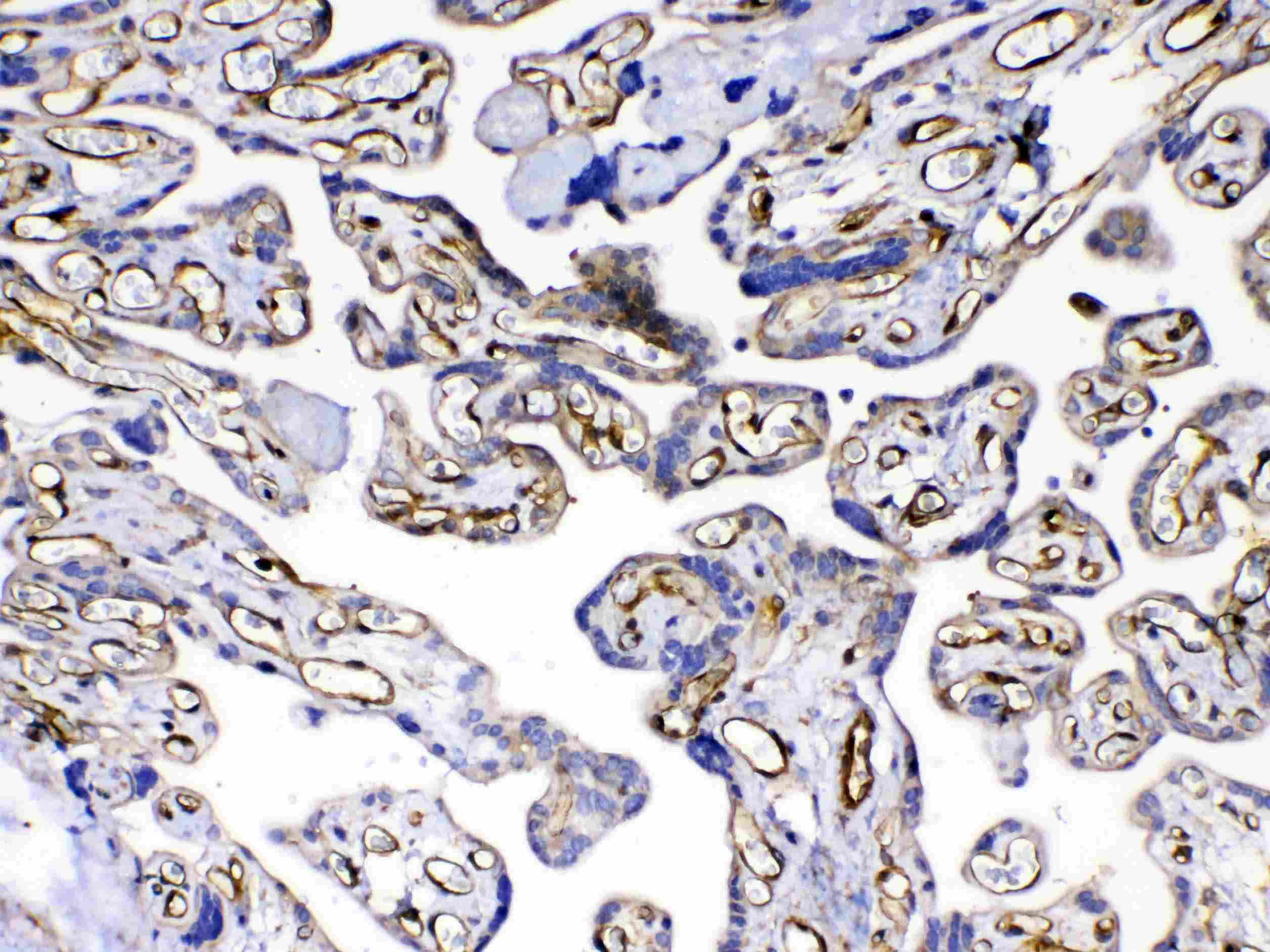 FLT4 / VEGFR3 Antibody