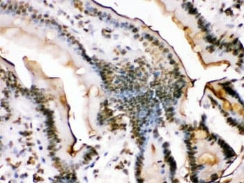 FOSB Antibody