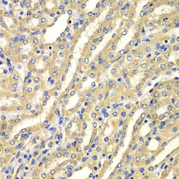 WIPI2 Antibody