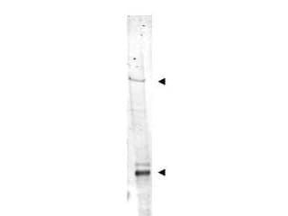 IDN3 / NIPBL Antibody