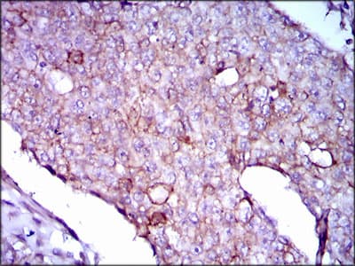 LPA / Lipoprotein a Antibody (clone 4H1)