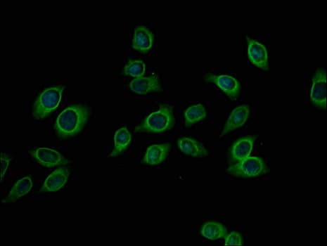 PFKM / PFK-1 Antibody