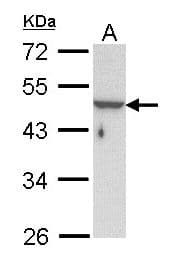 KRT33B / Keratin 33B / KRTHA3B Antibody (aa1-229)