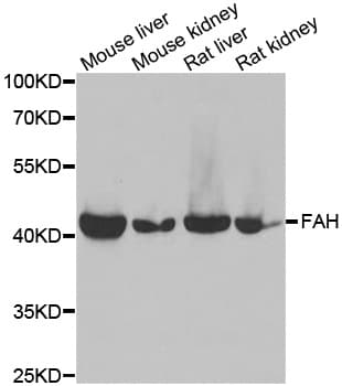 Polyclonal Rabbit anti-Human FAH Antibody (IHC, IF, WB)