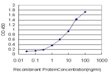 DPYD / DPD Antibody (clone 7D4)