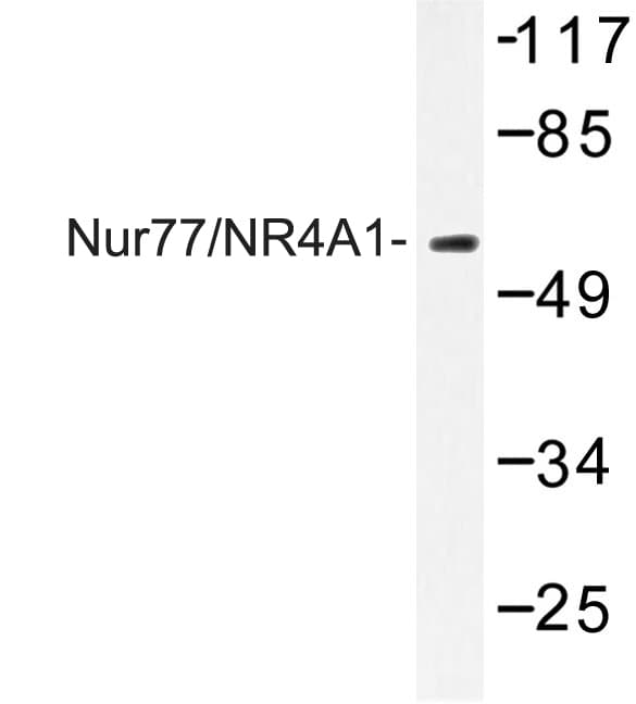NR4A1 / NUR77 Antibody (Gly347)