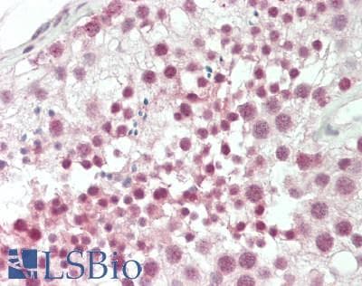 CSTF2 / CstF-64 Antibody (aa182-231)