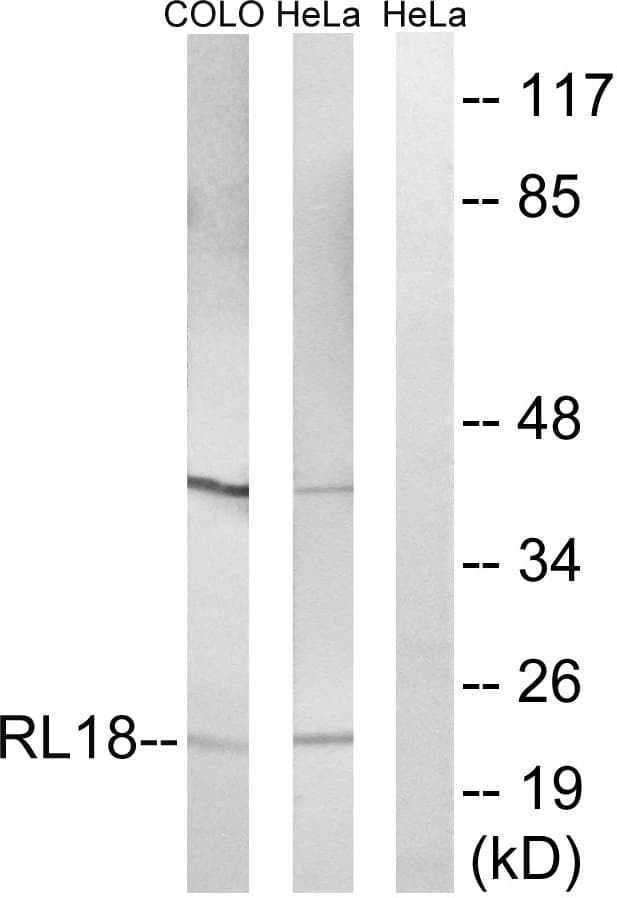 IHC-plus™ Polyclonal Rabbit anti-Human RPL18 / Ribosomal Protein L18 Antibody (aa111-160, IHC, WB)