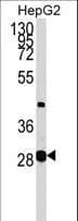 GLYCTK / Glycerate Kinase Antibody (aa107-135)