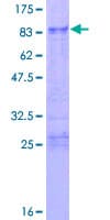 Human ZFP36L2 Protein (Recombinant GST)
