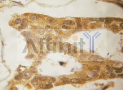 Polyclonal Rabbit anti-Human NR3C1/Glucocorticoid Receptor Antibody (IHC, IF, WB)