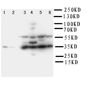 Polyclonal Rabbit anti-Rat PDPN / Podoplanin Antibody (aa155-166, WB)
